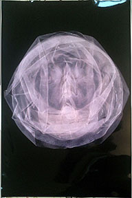 Blindspot Series. Scopopholio